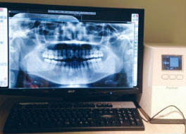 歯科用デジタルレントゲン
