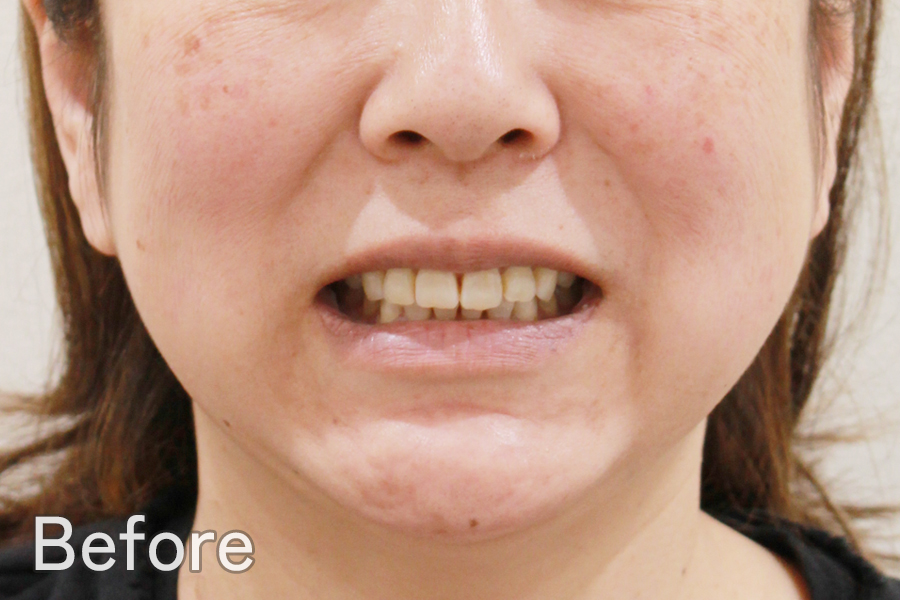 Before