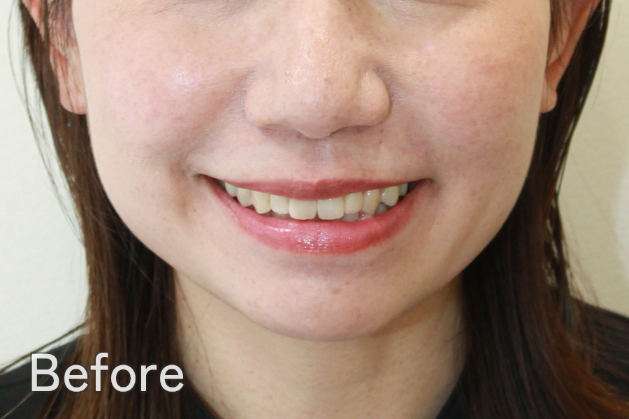 Before