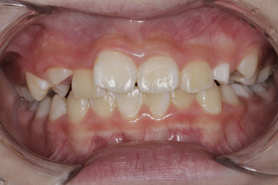 Before