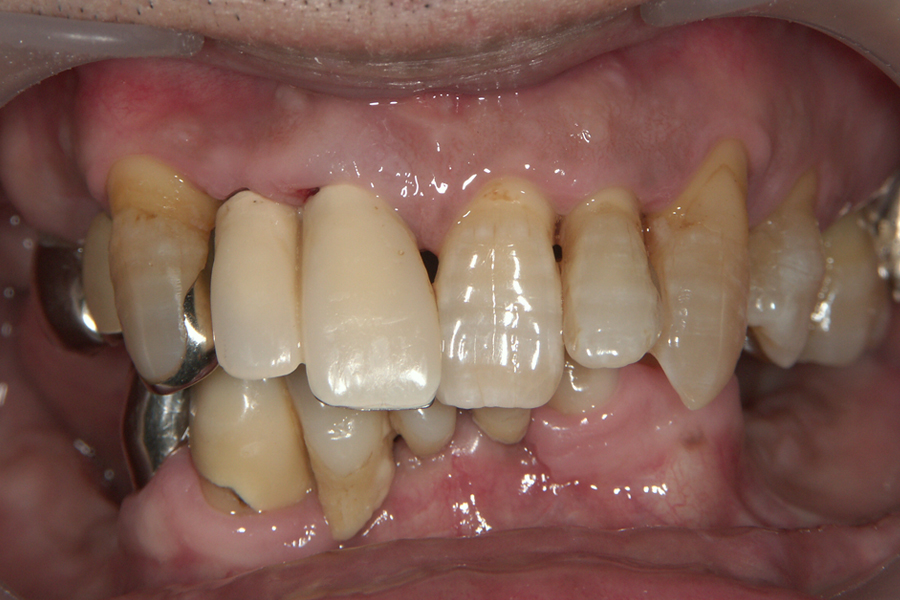 Before