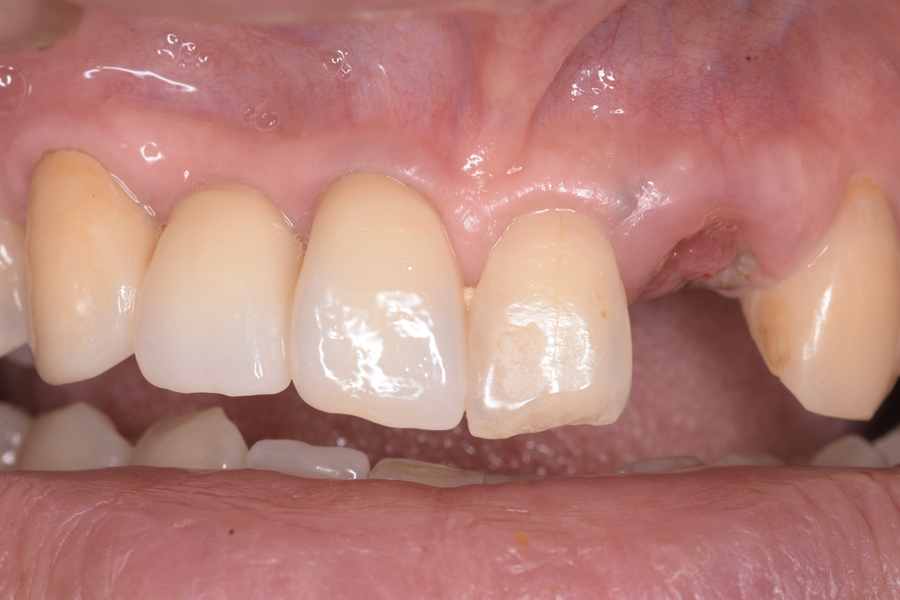 Before