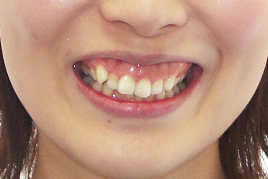 Before
